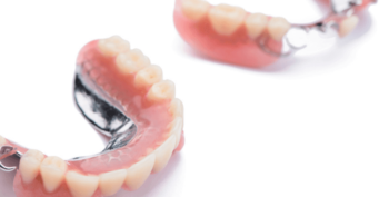 Prothèse fixe ou amovible - Cabinet dentaire - Dentiste Sanguinet